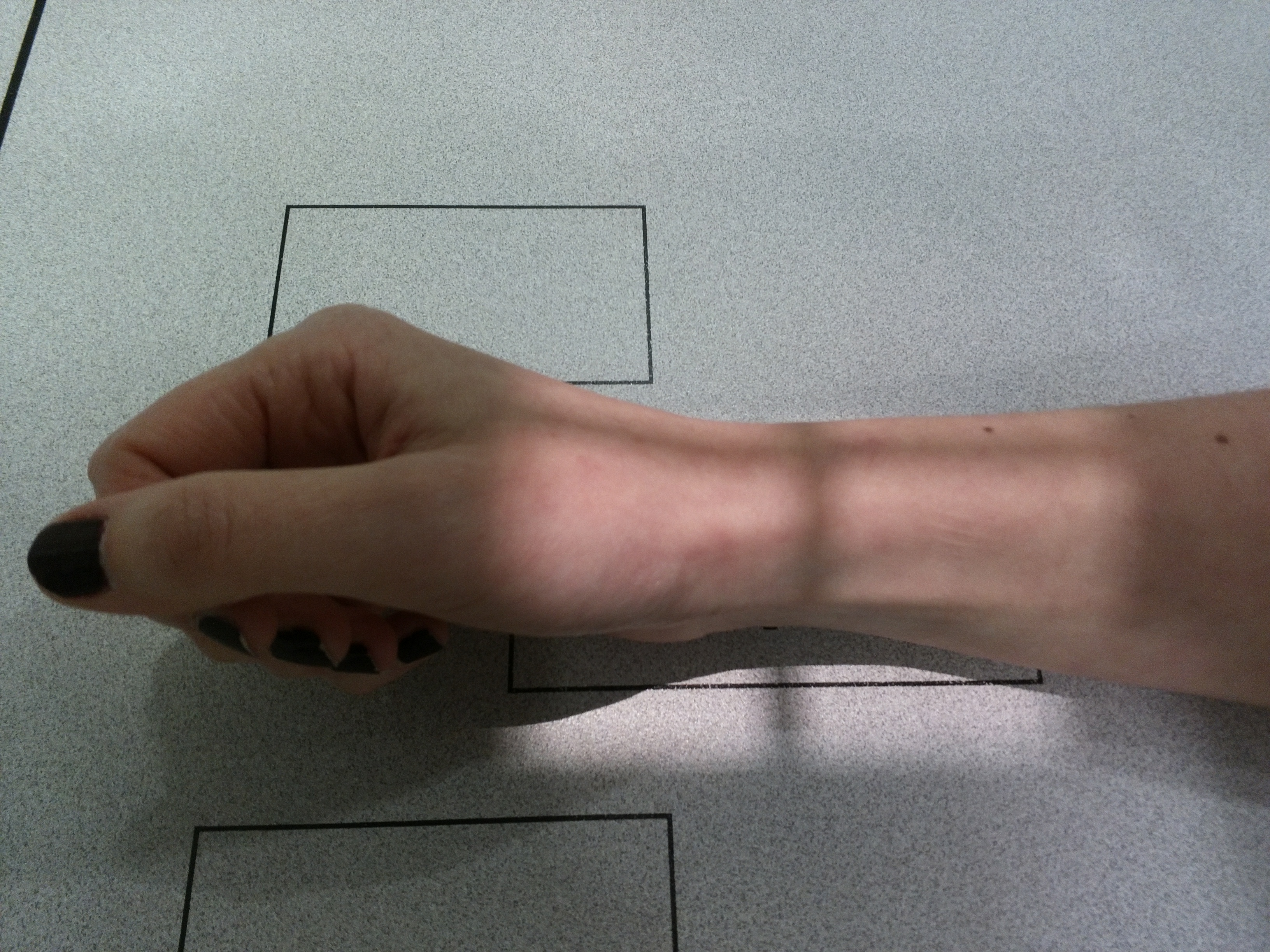 Lateral Wrist Radiograph